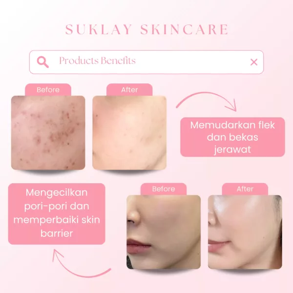 Suklay Serum Brightening & Cream 2in1 | Niacinamide, Arbutin, Salmon DNA, UV Filter | Mencerahkan, Memudarkan Flek, Melembapkan Kulit