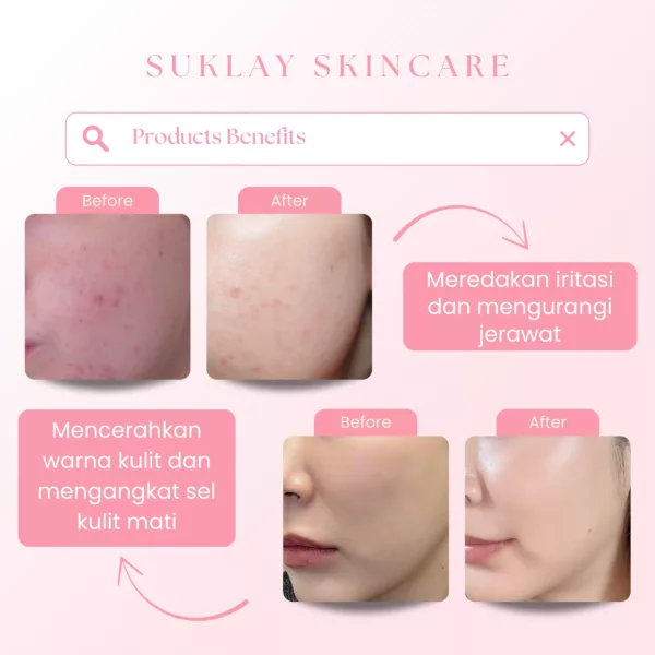 Suklay Paket 2 in 1 Daylight Glow – Brightening Toner & Cream