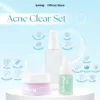 Suklay Spotless Glow Pack 3 in 1 - Acne Serum, Brightening Toner, Cream 2in1 | Niacinamide, Salicylic Acid, Ceramide, Hyaluronic Acid