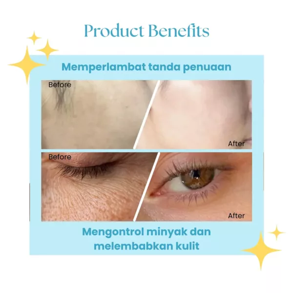 Suklay Paket 3 Set Acne Clear – Acne Serum, Face Wash, Toner | Salmon DNA, Niacinamide, Ceramide | Melembapkan & Mencegah Jerawat