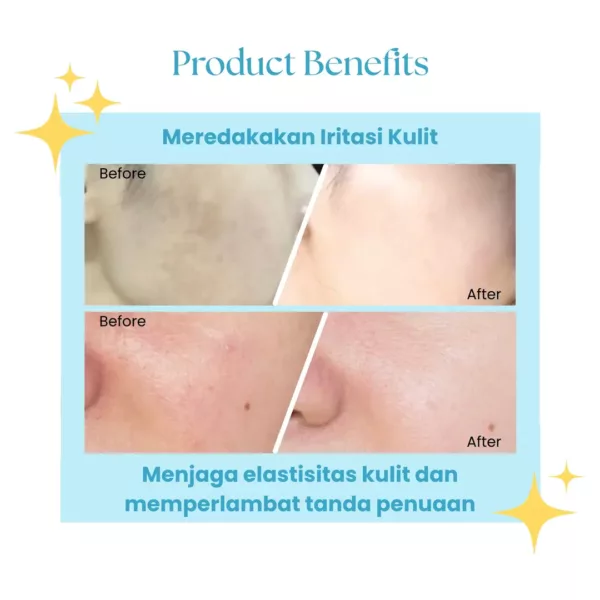 Suklay Paket 3 Set Radiant Skin – Face Wash + Toner + Cream | Menghidrasi, Redakan Iritasi, Cerahkan Kulit | 100ml + 100ml + 20gr