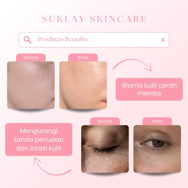 Suklay Glow Morning Set 3 in 1 – Salmon DNA, Niacinamide, Ceramide – Mencerahkan, Melembapkan, dan Meratakan Warna Kulit