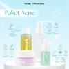 Suklay Anti Acne Paket 4 Set Cegah Jerawat & Repair Barrier (Face Wash + Toner + Serum + Cream)