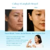 Suklay Anti Acne Paket 4 Set Cegah Jerawat & Repair Barrier (Face Wash + Toner + Serum + Cream)