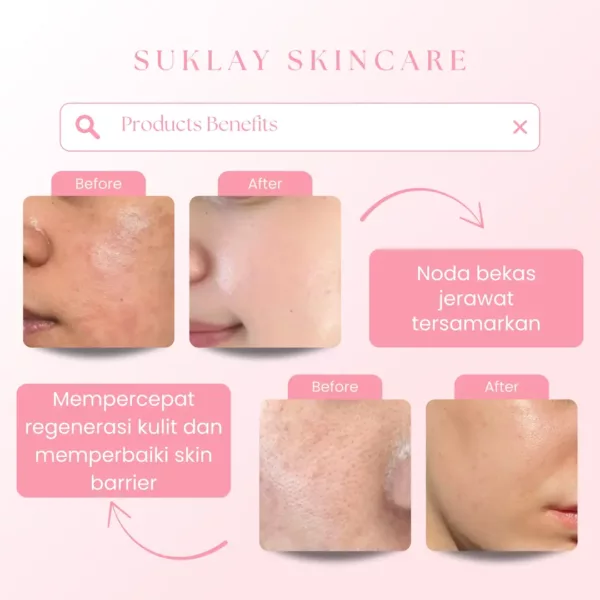 Suklay Glow Trio Set 3 in 1 – Toner, Serum, & Cream dengan Niacinamide, Peptide, Arbutin – Skincare untuk Mencerahkan, Menghilangkan Flek