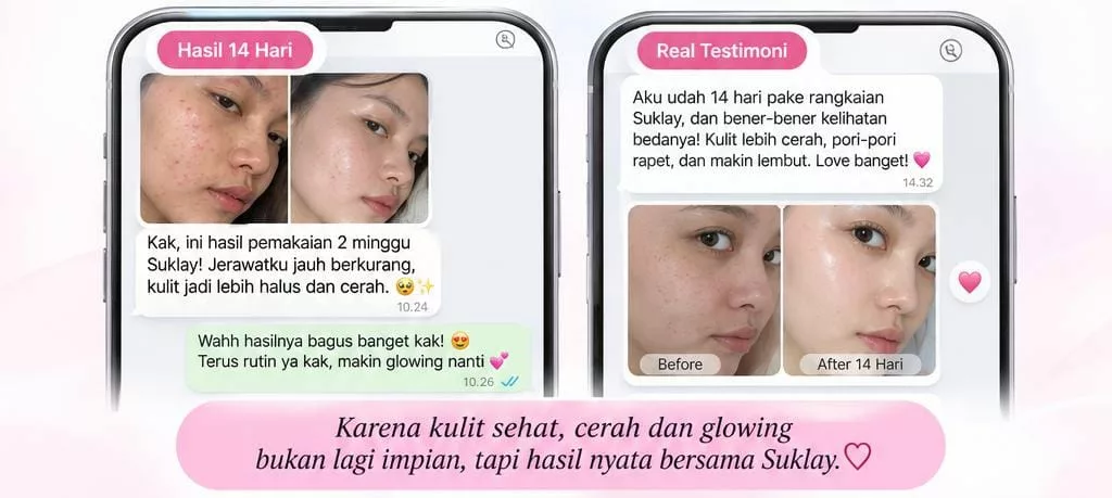 Bukti transformasi kulit pengguna Suklay 3